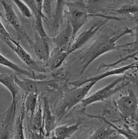 HC-OA细胞;成人软骨细胞-骨性关节炎