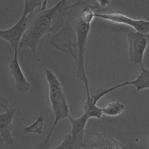 SW1353细胞;人软骨肉瘤细胞
