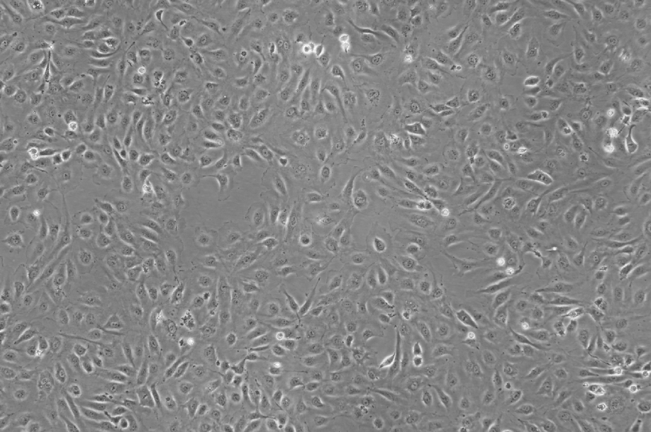 HUVEC细胞（人脐静脉内皮细胞（永生化）（SV40转染））