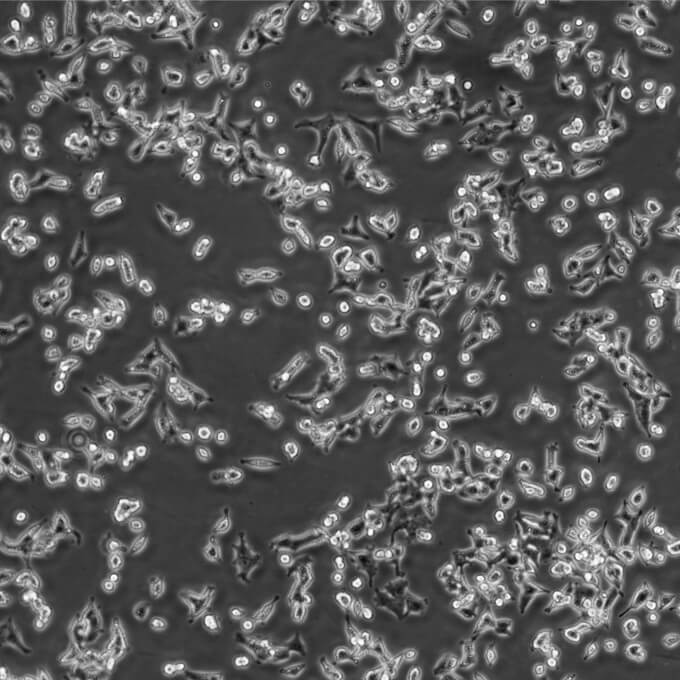 MIN6细胞（小鼠胰岛&beta;细胞株）