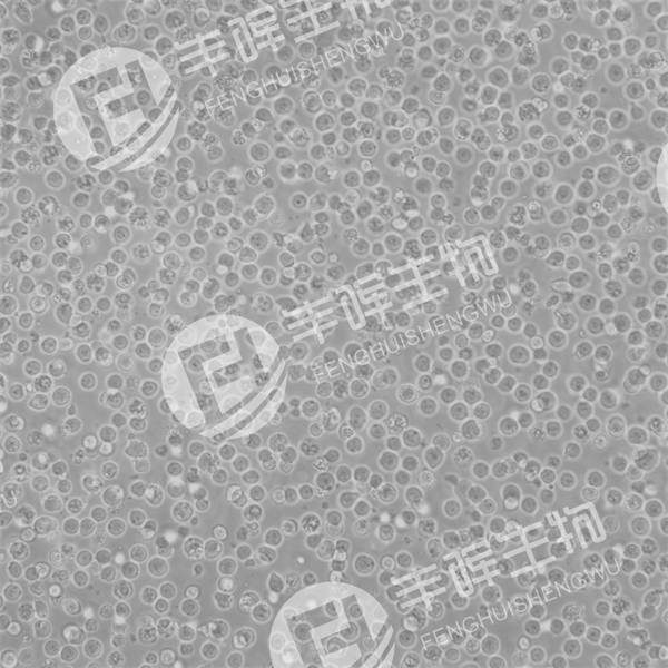 KG-1a细胞（人急性骨髓白血病细胞）