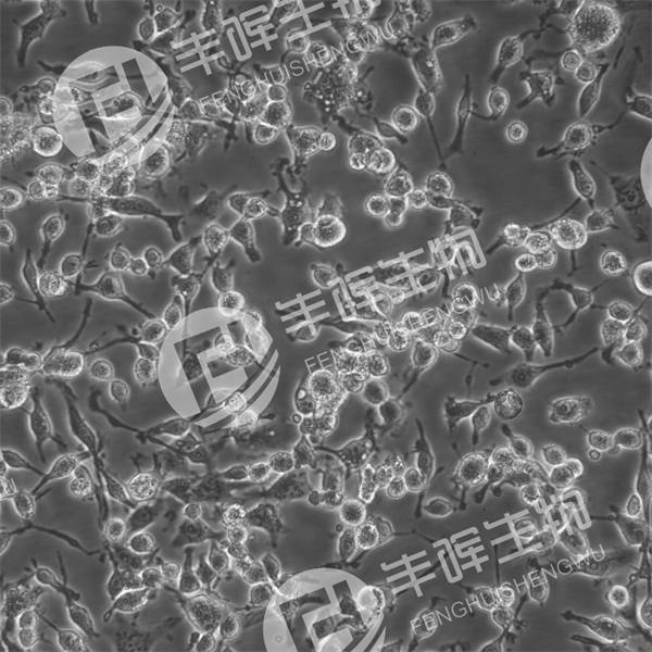 MDA-MB-436细胞（人乳腺癌细胞）