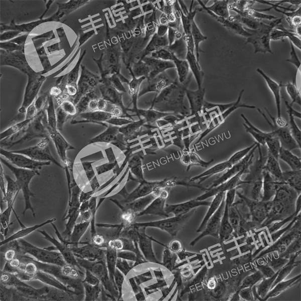 OCM1细胞（人眼脉络膜黑色素瘤细胞）