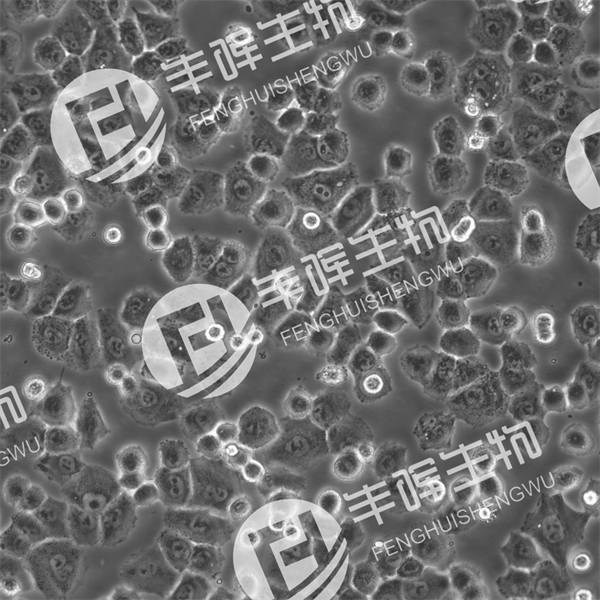 NCI-H460细胞（人大细胞肺癌细胞）