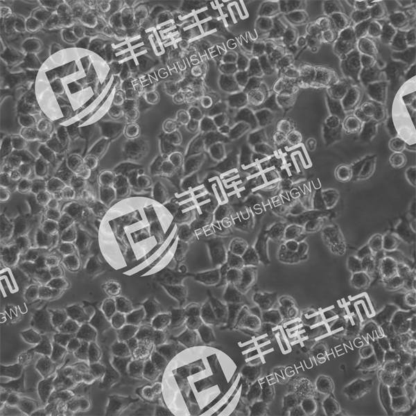 Neuro-2a细胞（小鼠脑神经瘤细胞）