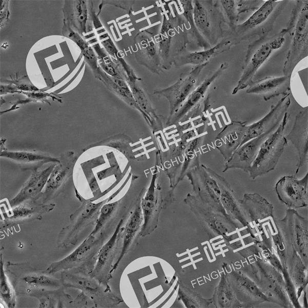 SF126细胞（人脑瘤细胞）