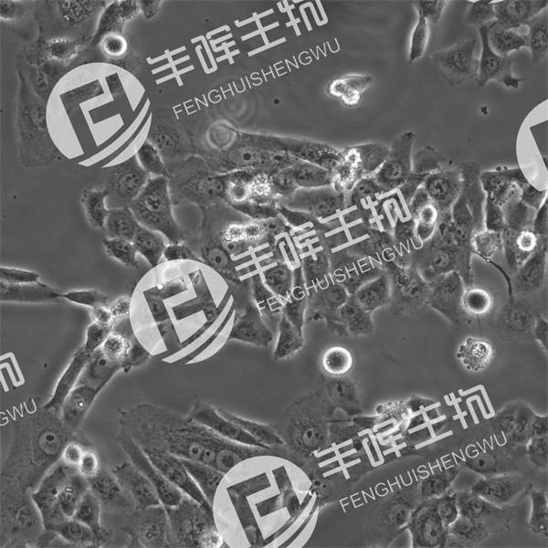 SK-HEP-1细胞（人肝腹水腺癌细胞）