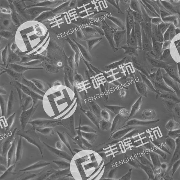 SK-MEL-28细胞（人皮肤恶性黑色素瘤细胞）