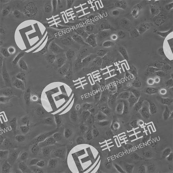 SKOV3细胞（人卵巢癌细胞）