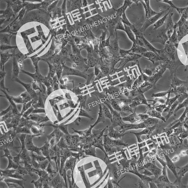 SV40-MES-13细胞（小鼠肾小球系膜细胞）