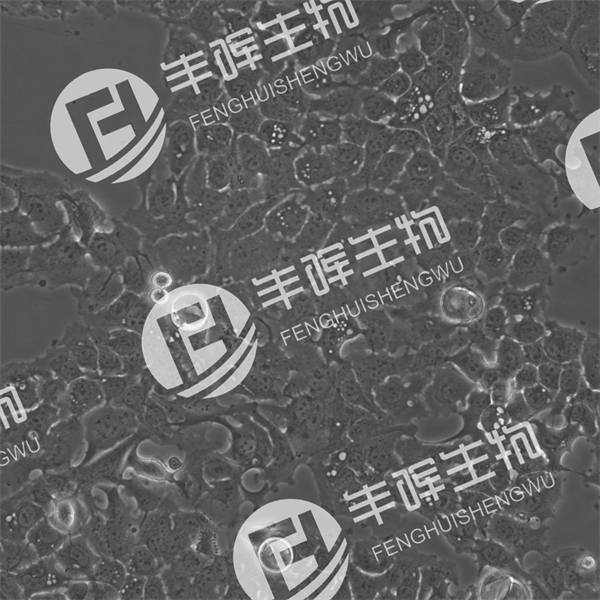 SW780细胞（人膀胱移行细胞癌）