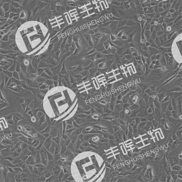 T98G细胞（人胶质母细胞瘤）