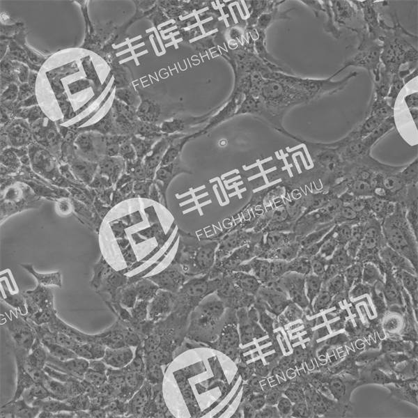 SW837细胞（人直肠腺癌上皮细胞）