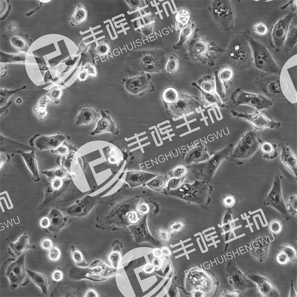 caki-1细胞（人肾透明细胞癌皮肤转移细胞）