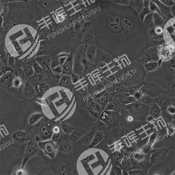 HCC1937细胞（人乳腺癌细胞）