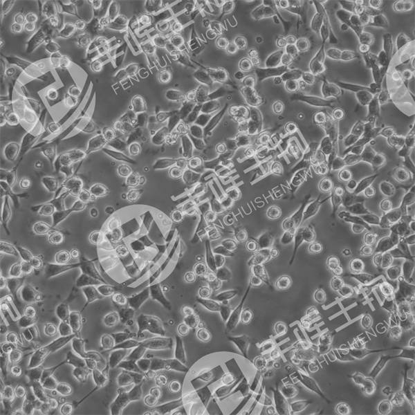 TCMK1细胞（小鼠肾小管上皮细胞）