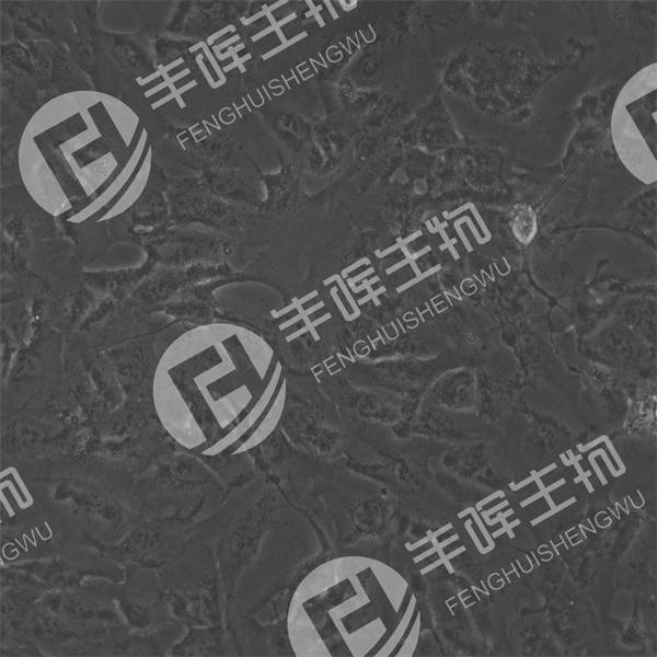 RBE细胞（人胆管癌细胞）