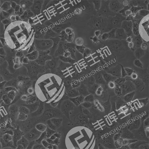 NCI-H522细胞（人非小细胞肺癌腺癌细胞）