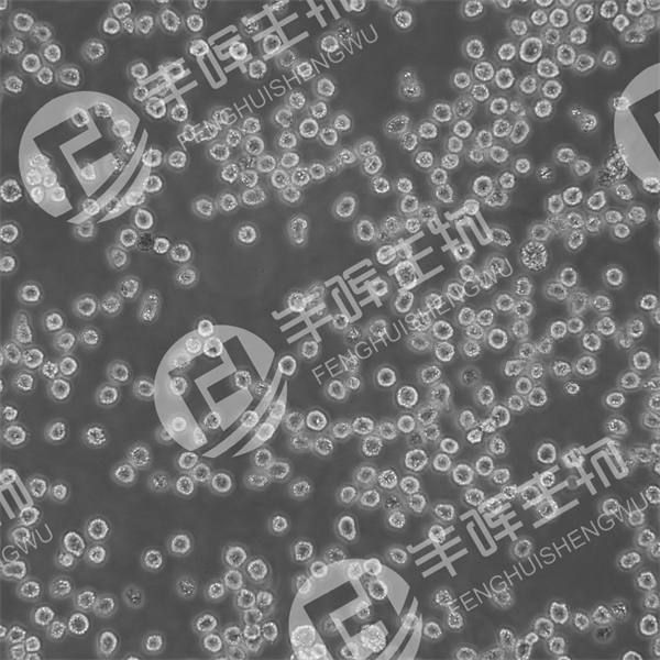 Kasumi-1细胞（人红白血病细胞/人急性髓母白血病细胞）