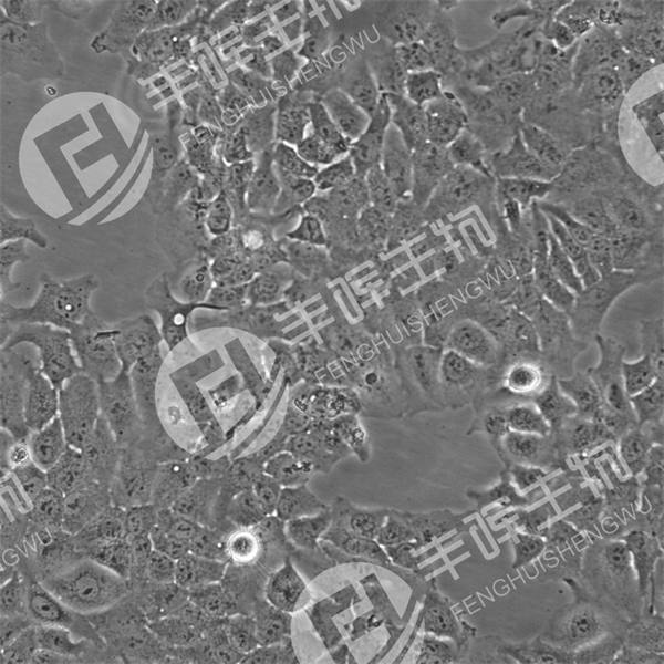 FU-MMT-1细胞（人子宫肉瘤细胞）