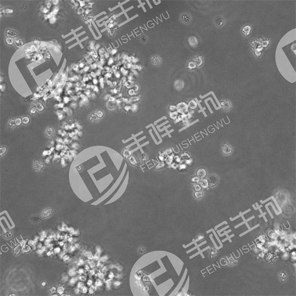 MT-4细胞（人T细胞白血病细胞）