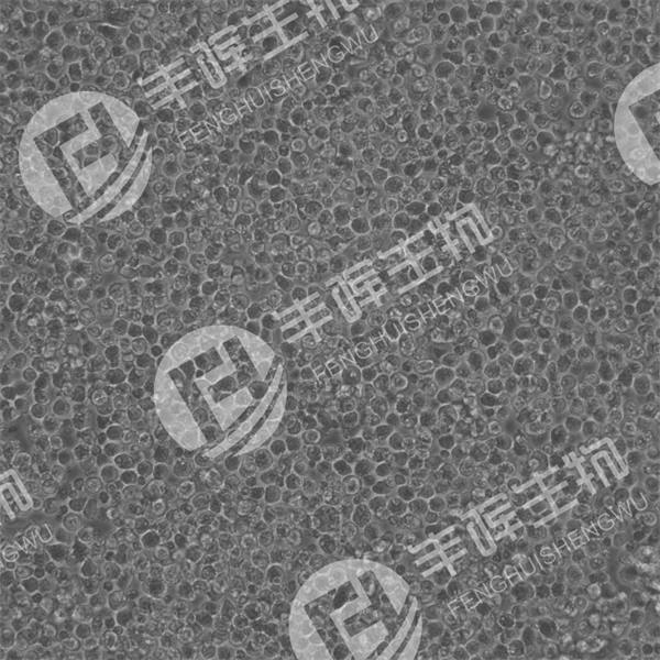 P815细胞（小鼠肥大细胞瘤细胞）