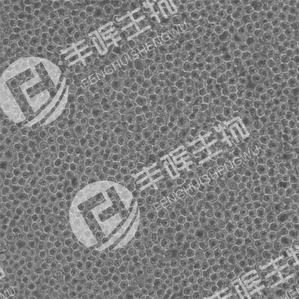 MPC-11细胞（小鼠浆细胞瘤）