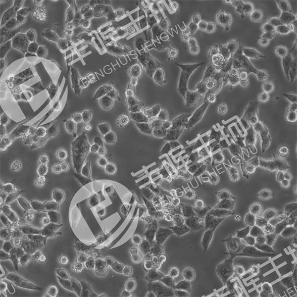 LA795细胞（小鼠肺腺癌细胞）