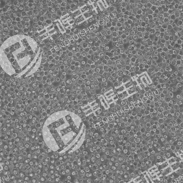 CA-46细胞（人burkitt淋巴瘤细胞）