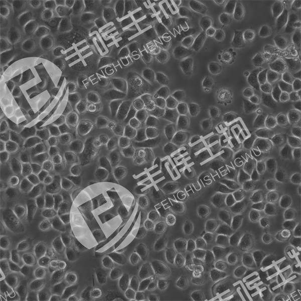 ME-180细胞（人子宫颈表皮癌细胞）