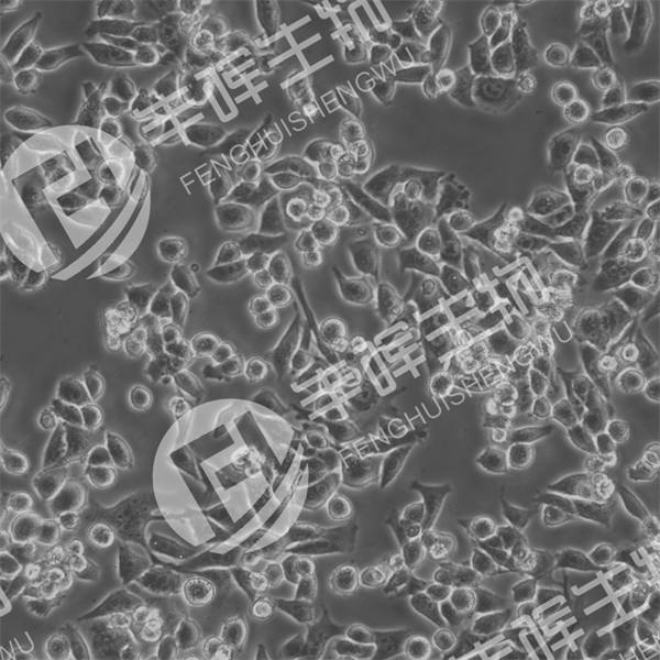 4T1.2细胞（小鼠乳腺癌细胞(骨转移模型)）