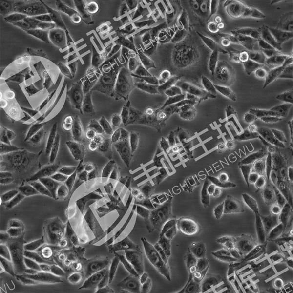 SKOV3IP细胞（人卵巢腺癌细胞）