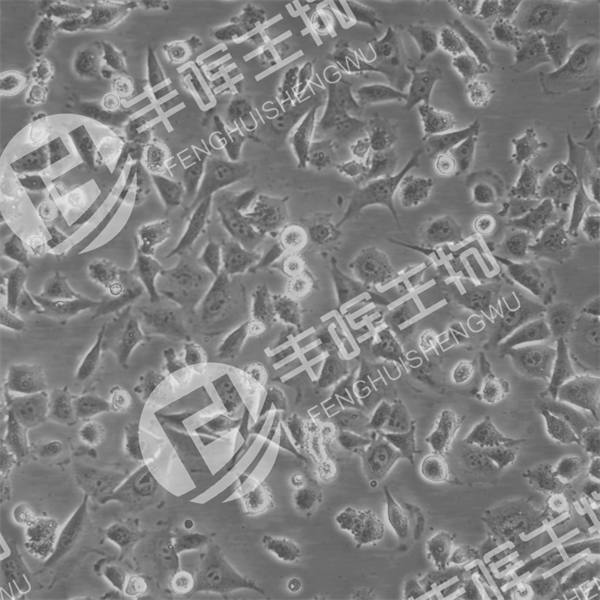 pan02细胞（小鼠胰腺癌细胞）