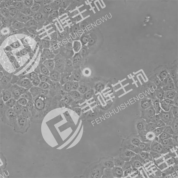HPaSteC细胞（人胰腺星状细胞）