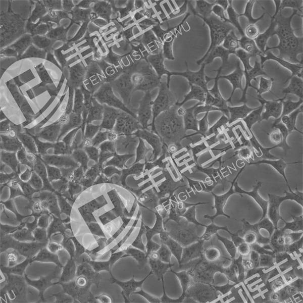 GP2-293细胞（人胚肾上皮包装细胞）