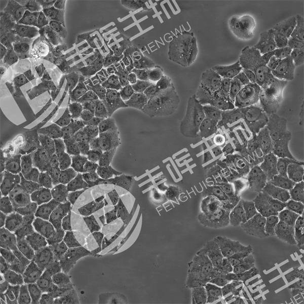 CAOV-3细胞（人卵巢癌细胞）