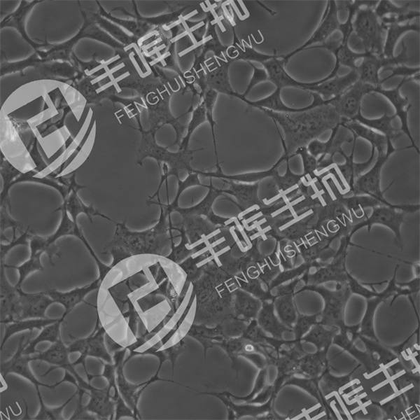 WSS-1细胞（人胚肾细胞）