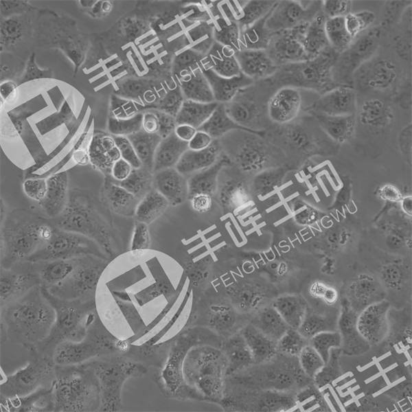 IGROV1细胞（人卵巢癌细胞/卵巢子宫内膜样腺癌）