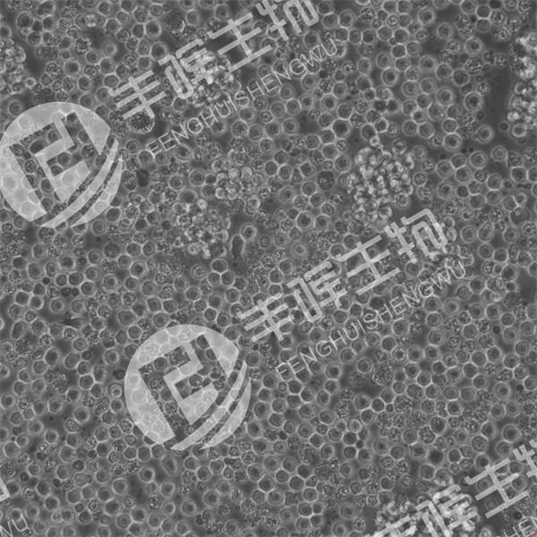 NCI-H128细胞（人小细胞肺癌细胞）