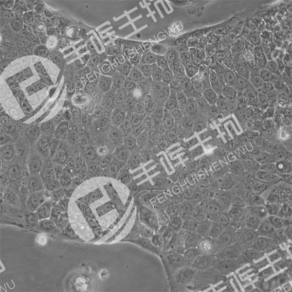 Capan-2细胞（人胰腺癌细胞）