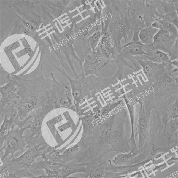 hpne细胞（正常人胰管上皮细胞）