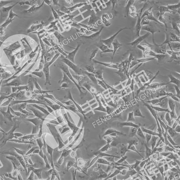 Rat podocyte细胞（大鼠肾足细胞）