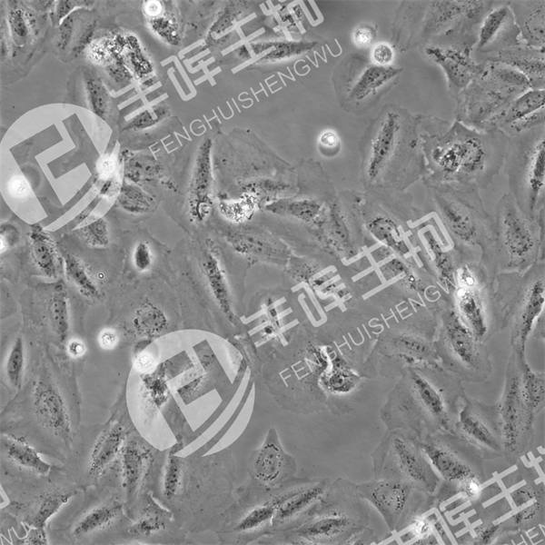 SJSA-1细胞（人骨肉瘤细胞）