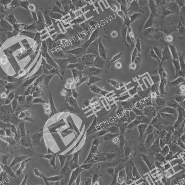 MOVAS细胞（小鼠主动脉平滑肌细胞）