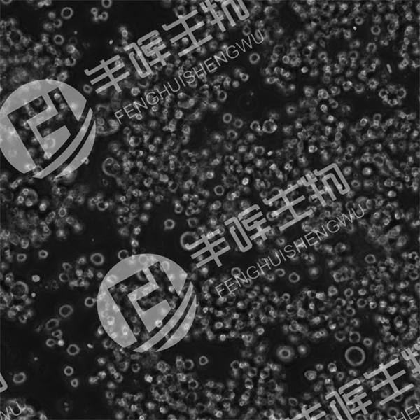 COLO201细胞（人结直肠腺癌细胞）
