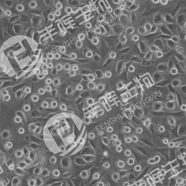 SACC-LM细胞（人唾液腺腺样囊性癌）