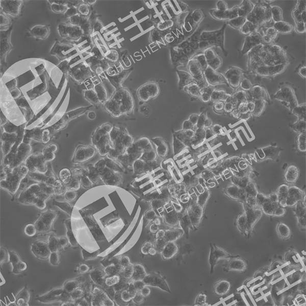 TUBO细胞（小鼠乳腺癌细胞）