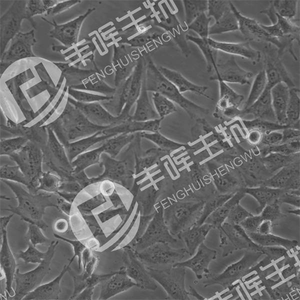 A2058细胞（人黑色素瘤细胞）