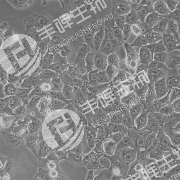BHT101细胞（人甲状腺癌细胞）