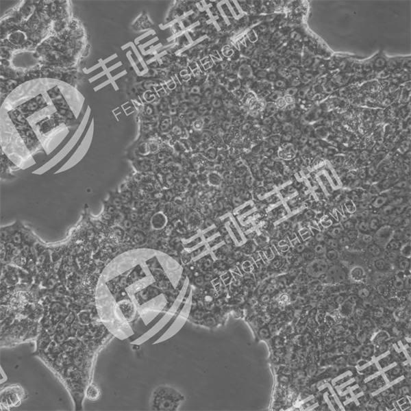 Capan-1细胞（人胰腺癌细胞）